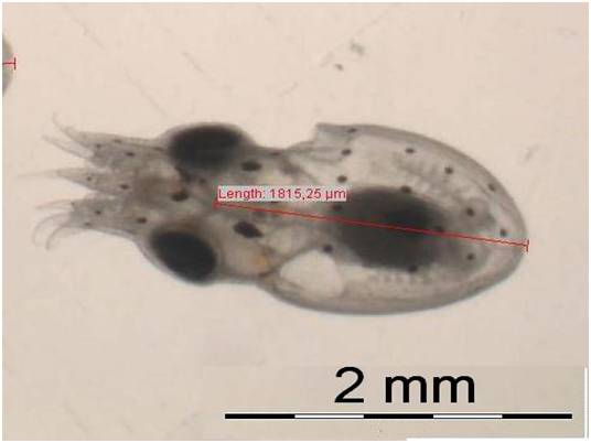 Paralarva recién eclosionada. Medida de la longitud del manto hecha con el programa Cell^D, de Olympus