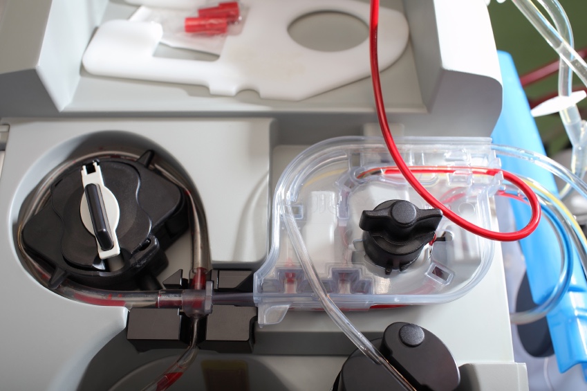 Imatge d'un equip d'hemodiàlisi
